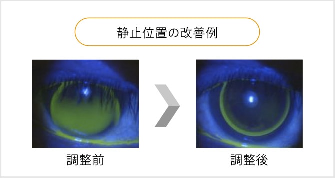 静止位置の改善例