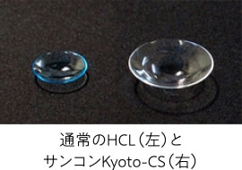 通常のHCL（左）とサンコンKyoto-CS（右）